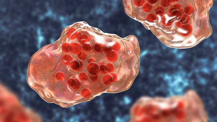 Texas announces second death in measles outbreak